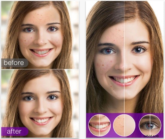 Rode ogen verwijderen van iPhone-foto s:eenvoudige oplossingen en gratis tools 